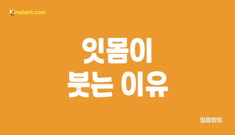 잇몸이 붓는 이유