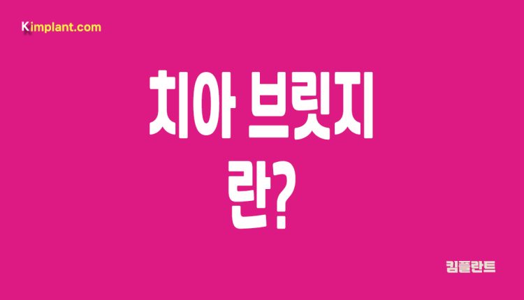 치아 브릿지 대문