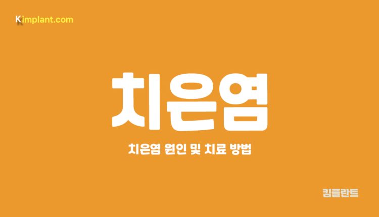 치은염 원인 대문