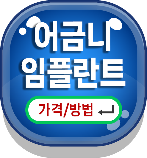어금니 임플란트 가격