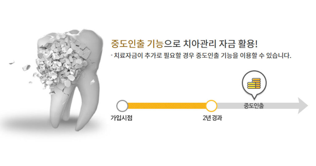 KB치아보험 중도인출 치과치료비 충당할 수 있는 꿀팁 